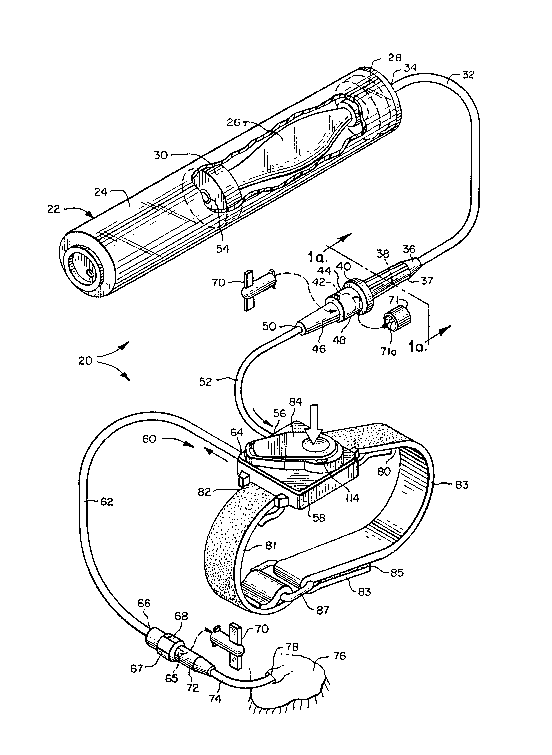 A single figure which represents the drawing illustrating the invention.